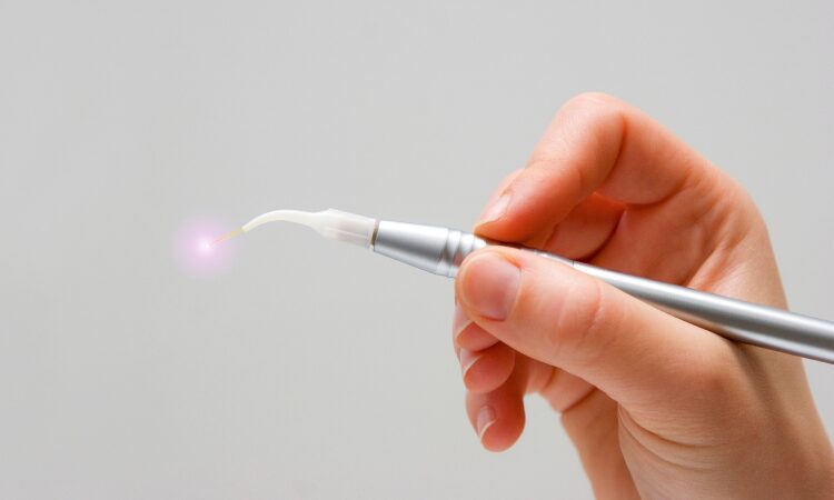 Laser dentistry has gained significant popularity in recent years. Dentists use lasers for a variety of procedures.
